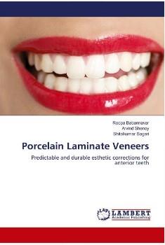 Porcelain Laminate Veneers