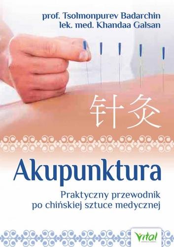 AKUPUNKTURA